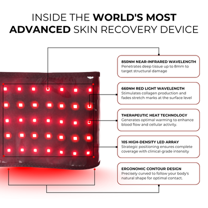 Affirma Red Light Therapy Belt