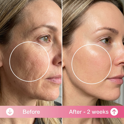 Slumbl Anti-wrinkle Pillow